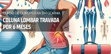 Coluna Lombar Travada por 6 Meses